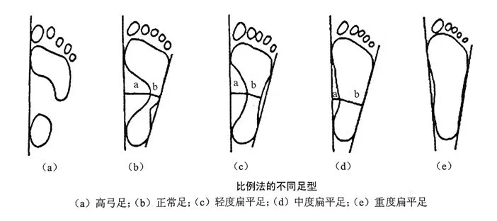 基于足底压力检测的步态病理分型