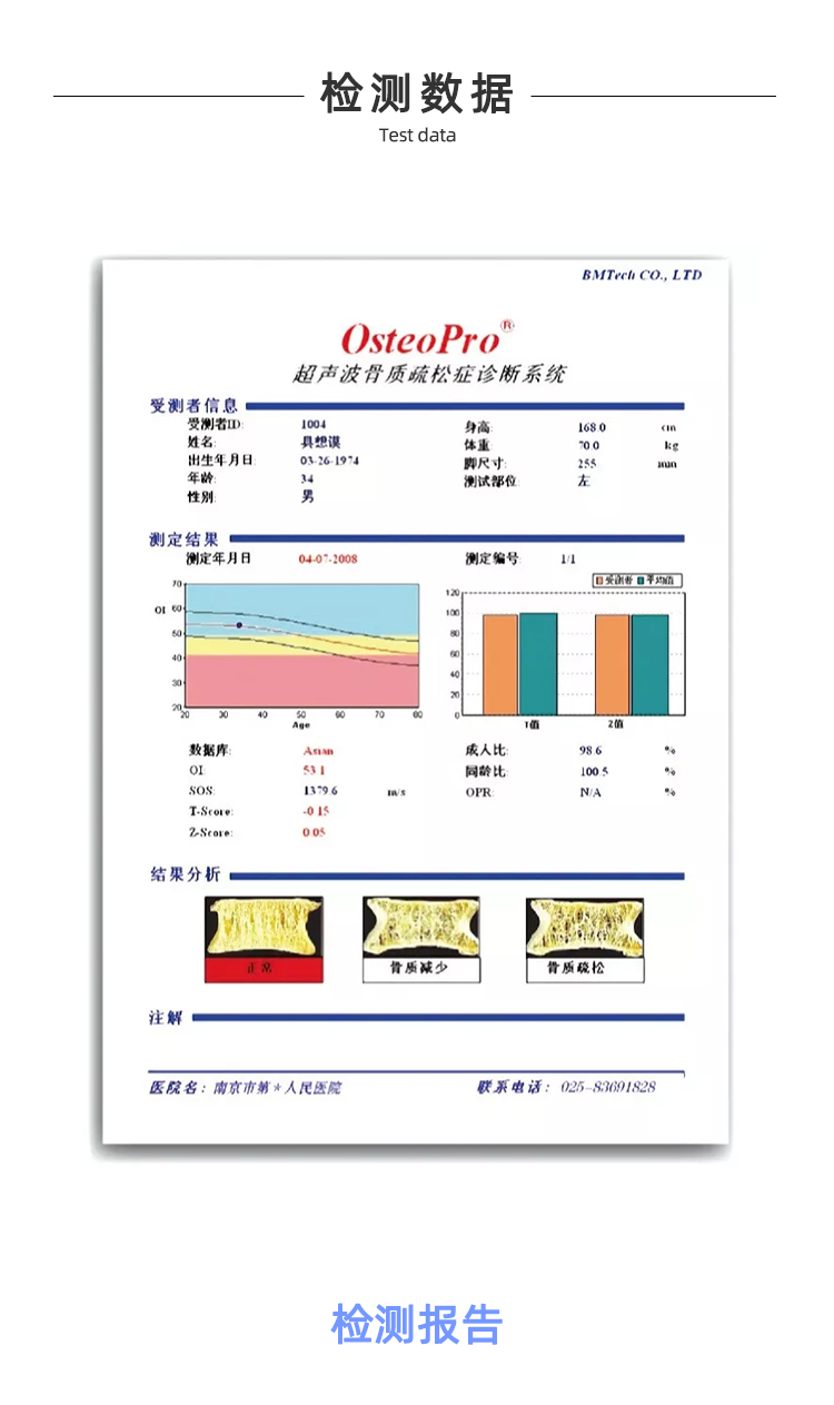 超声骨密度仪