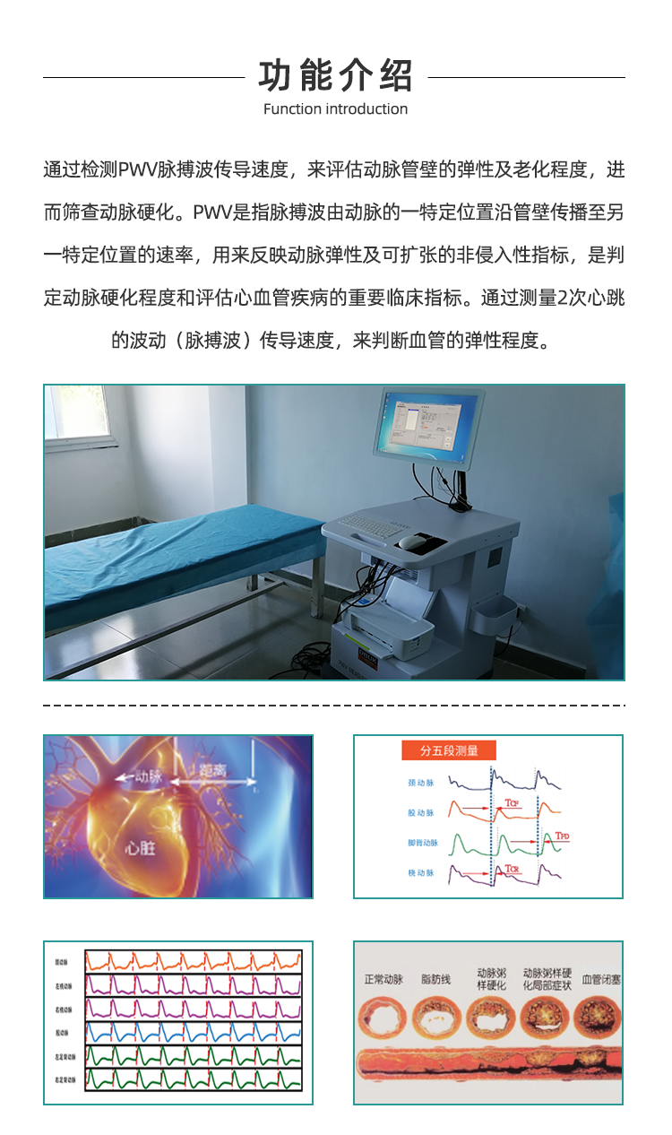 动脉硬化检测仪