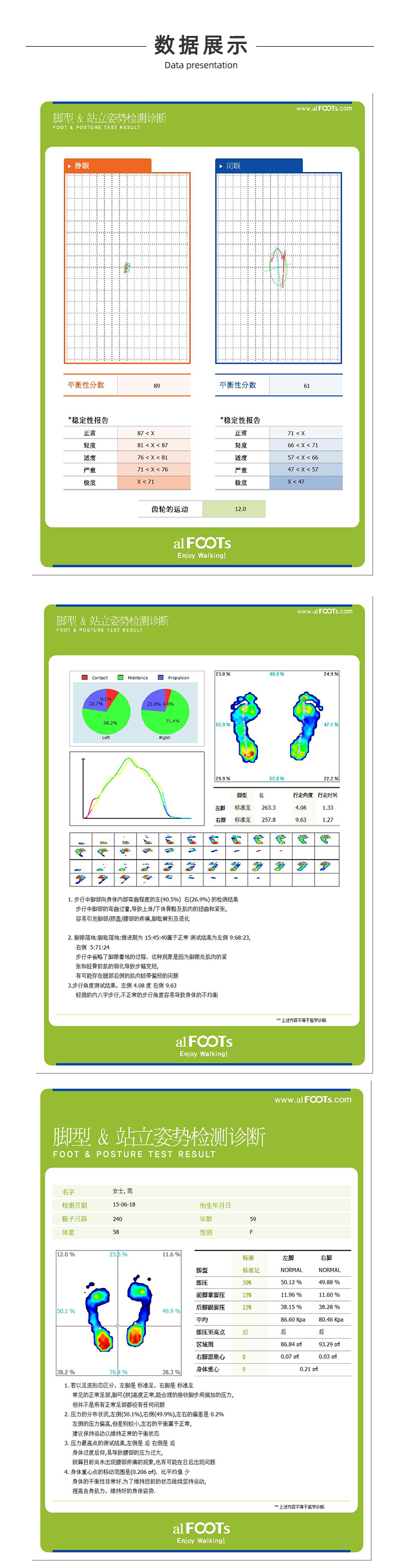 足底压力分析仪