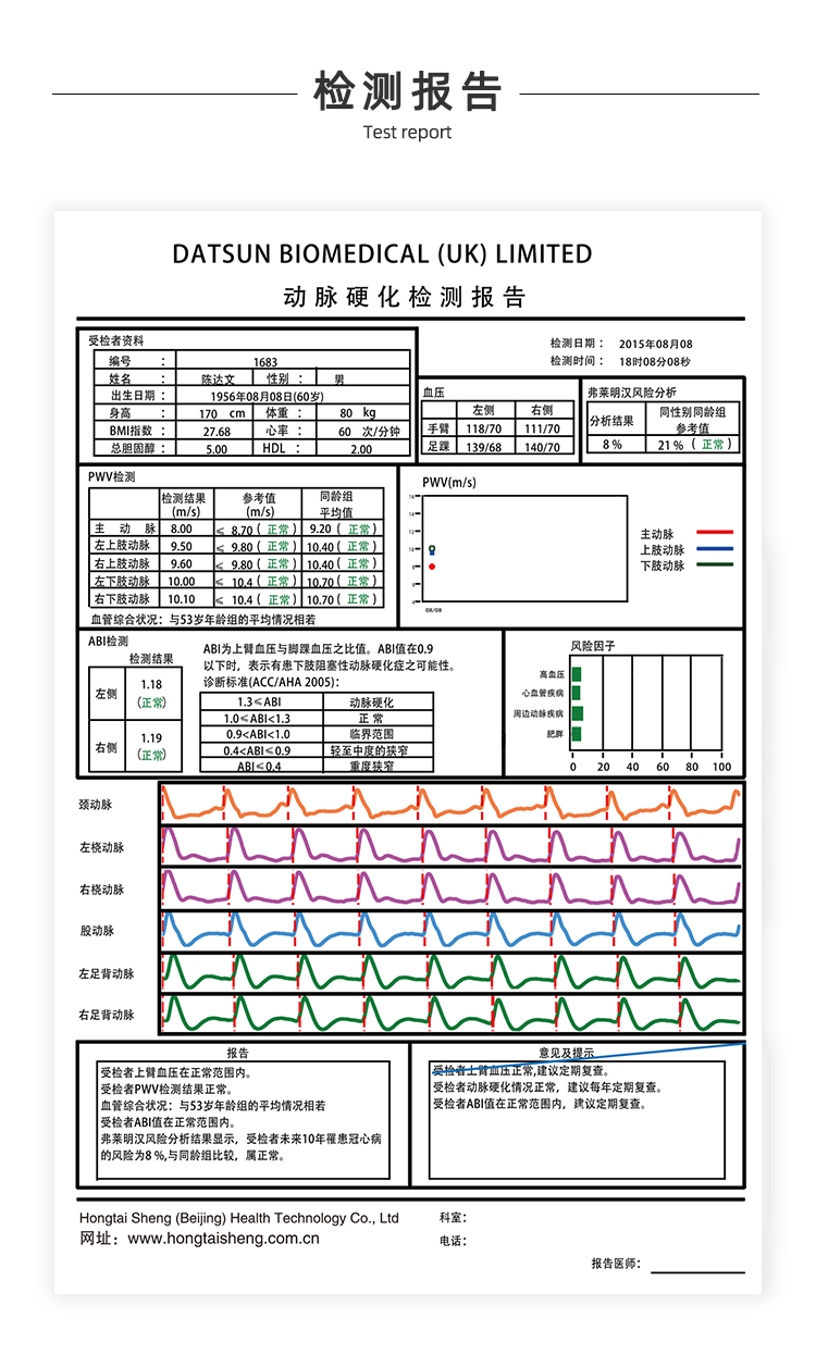 脉搏波速测定仪