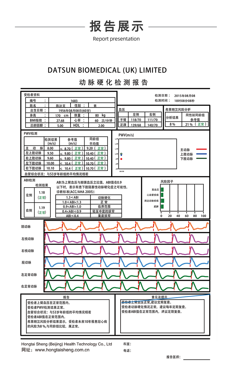 动脉硬化检测仪