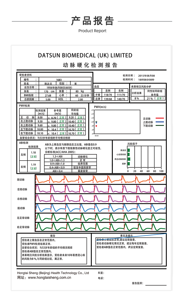 动脉硬化检测仪