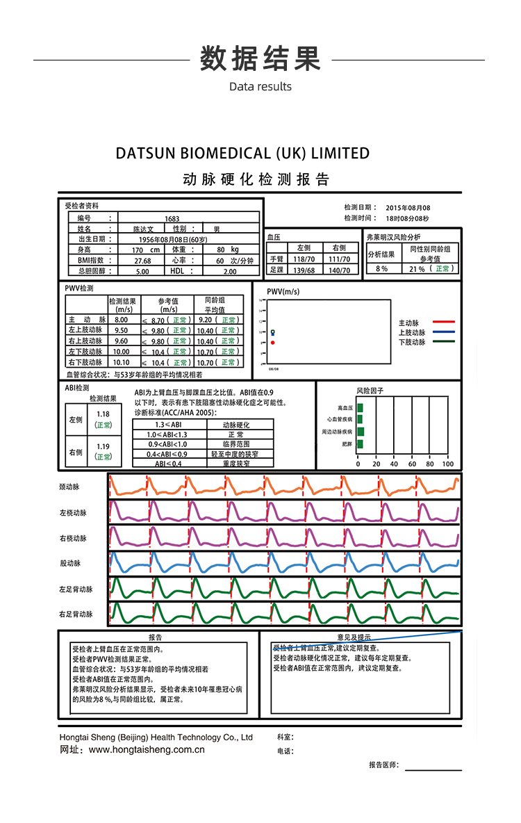 动脉硬化检测仪