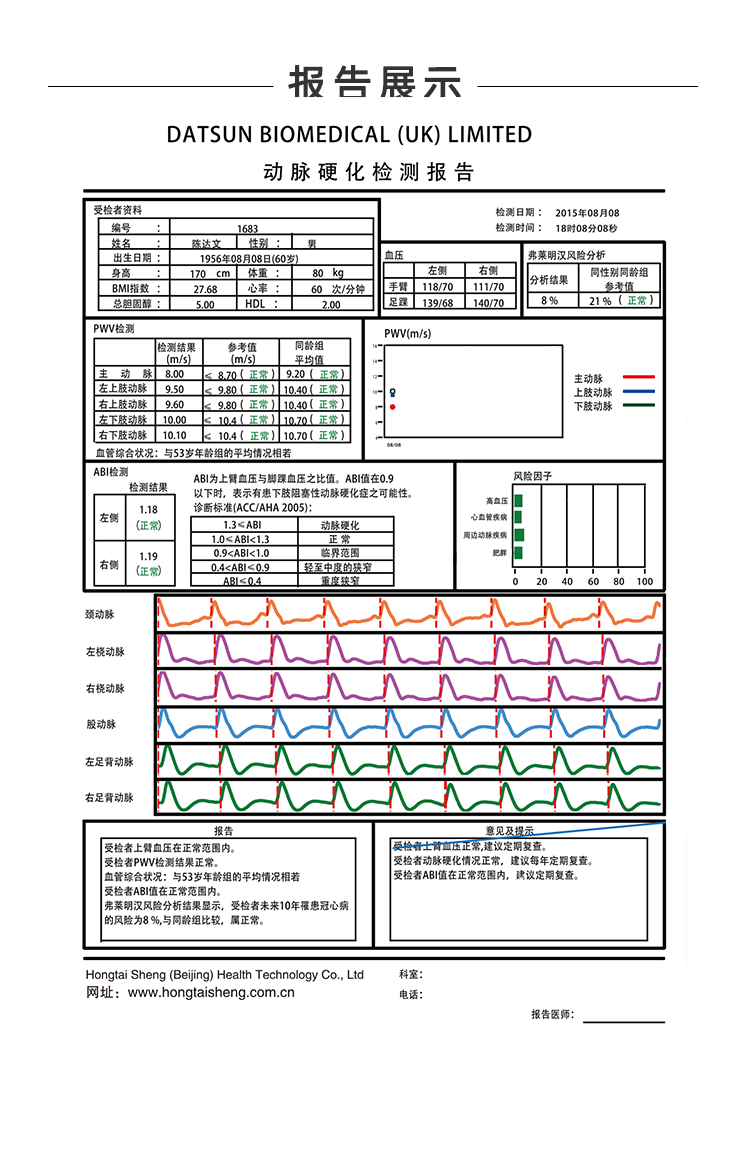 脉搏波速测定仪