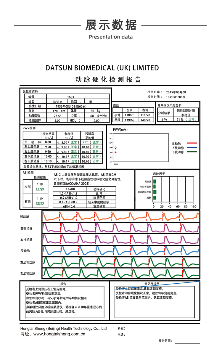 脉搏波速测定仪