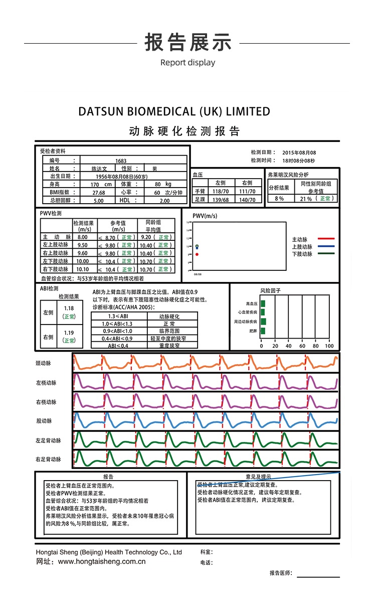 动脉硬化检测仪