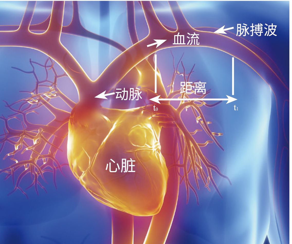 动脉硬化解析