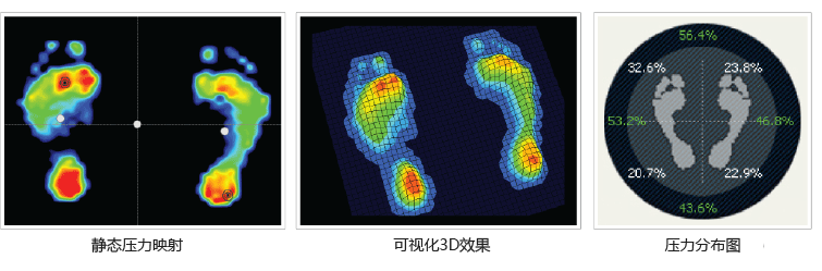 步态分析